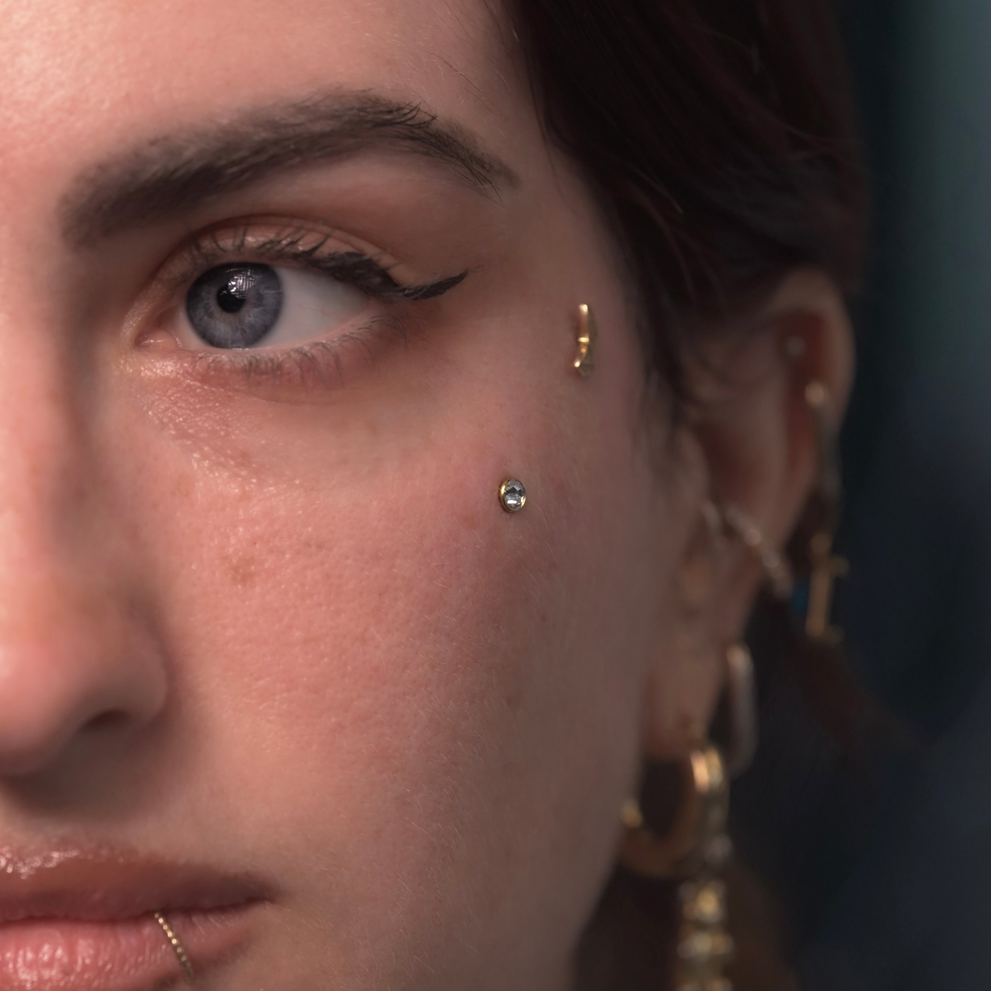 Image of Microdermal